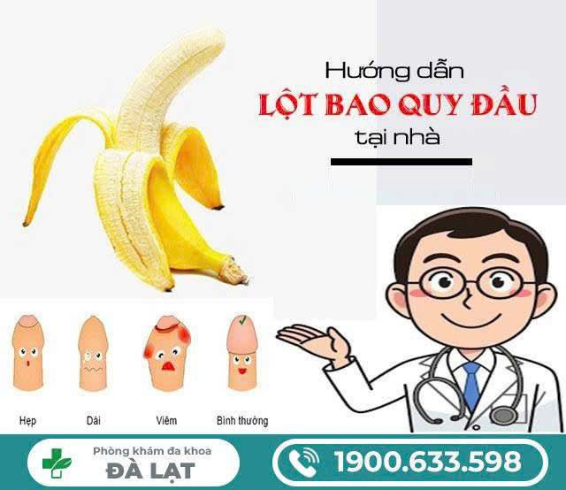 Hình ảnh minh họa